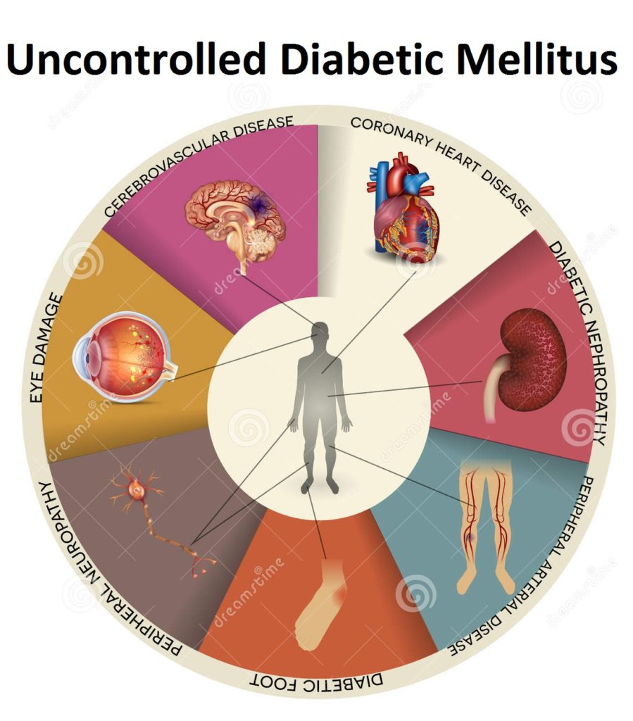 Uncontrolled Diabetes Mellitus