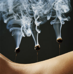 Moxibustion