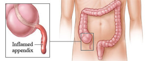 Appendix