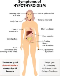 Symptoms of Hypothyroidism